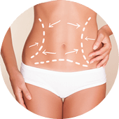 Coolsculpting